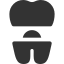 Tooth Crown in Hyderabad